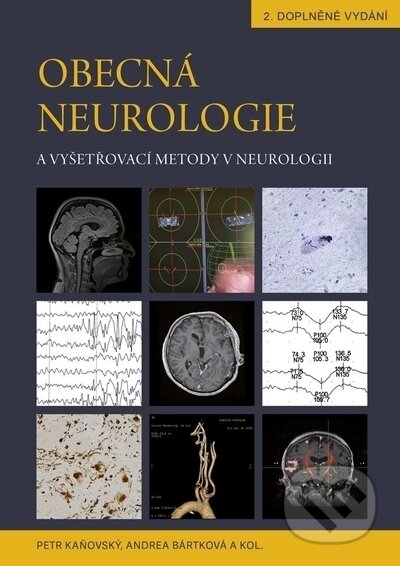 Obecná neurologie a vyšetřovací metody v neurologii-Andrea Bártková a Petr Kaňovský