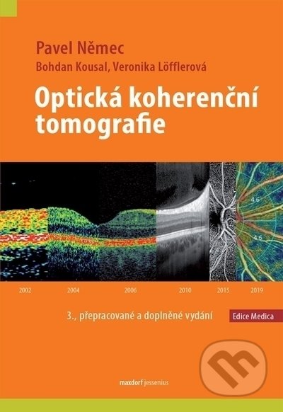 Optická koherenční tomografie-Bohdan Kousal