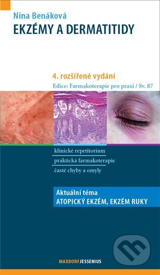 Ekzémy a dermatitidy-Nina Benáková