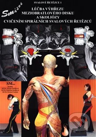 Léčba výhřezu meziobratlového disku bez operace-Kateřina Smíšková